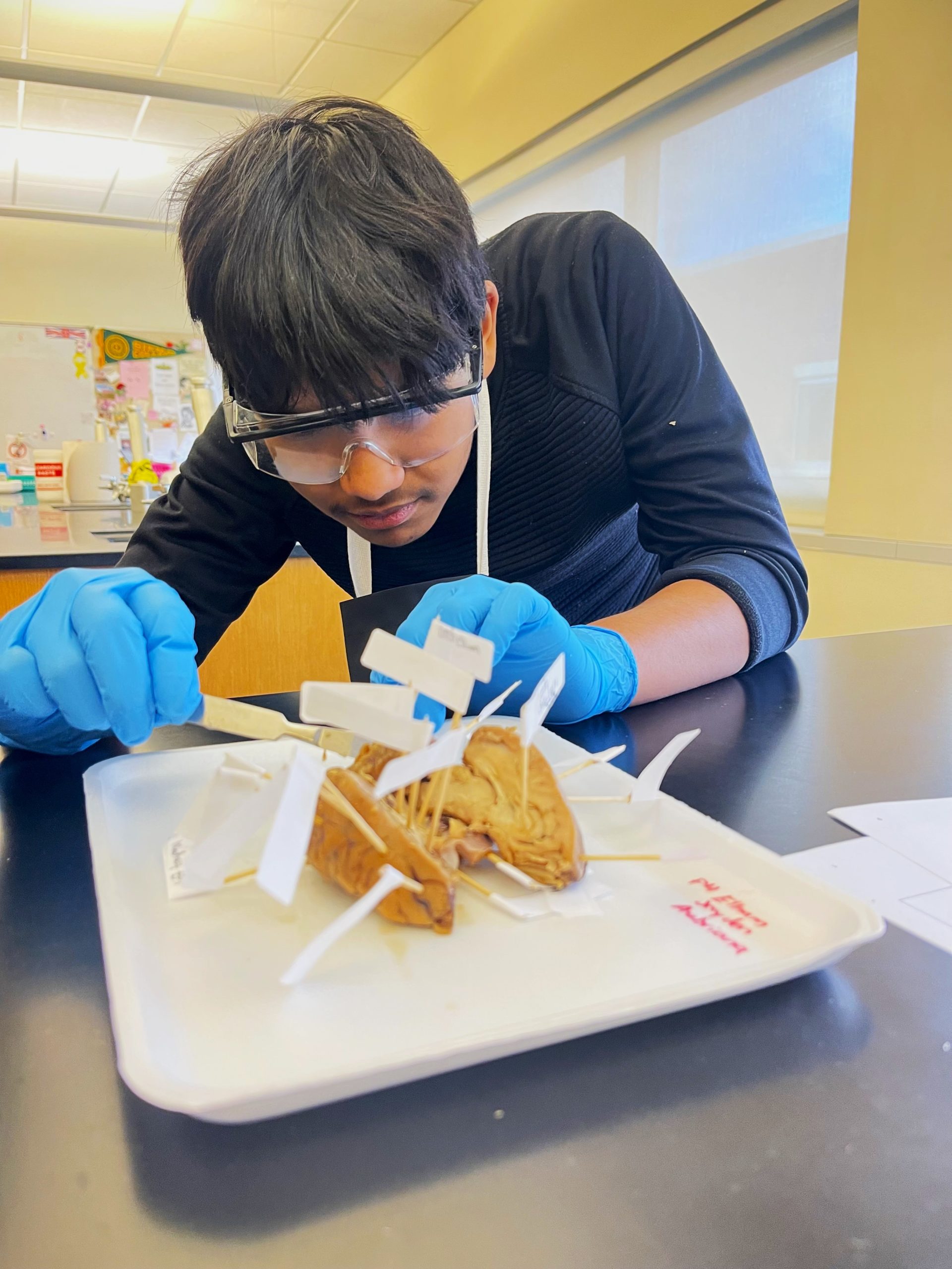 Cerebral Peduncle: Why Sheep Brains Matter To Science - h51szhe